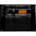 T Trådlös Ultraljud Vascular Crosscut &amp; Longitudinal Probe